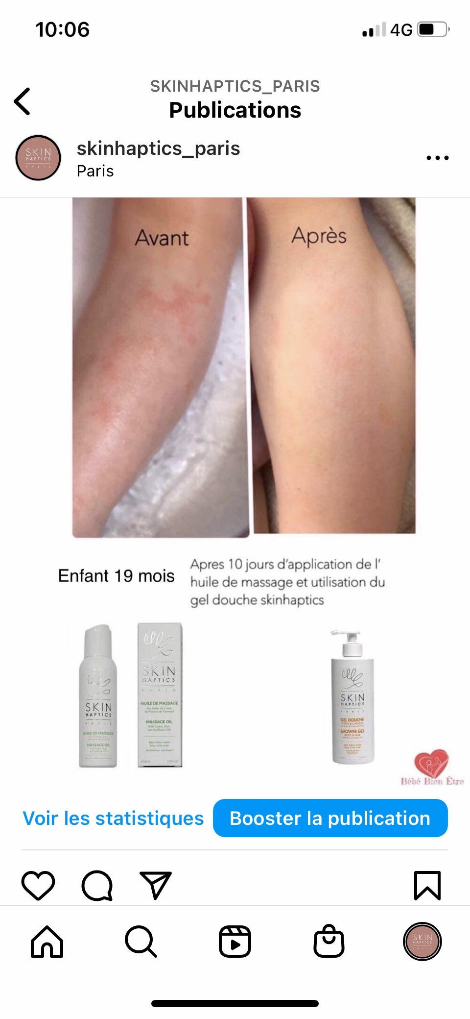 Avant-après 10 jours gel douche et huile de massage skinhaptics