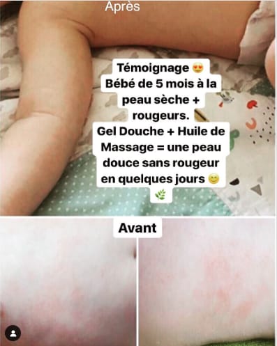 bébé 5 mois avant après